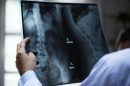 salute delle ossa, medico che analizza una radiografia