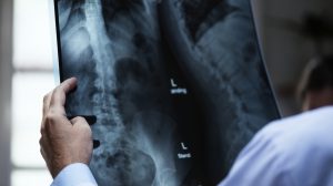 salute delle ossa, medico che analizza una radiografia